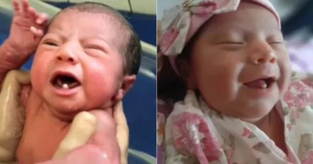 Bebê nasce com dois dentes e viraliza nas redes sociais