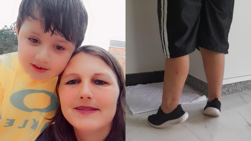 Mãe de Tijucas precisa de ajuda para cirurgia de filho autista que só anda na ponta dos pés