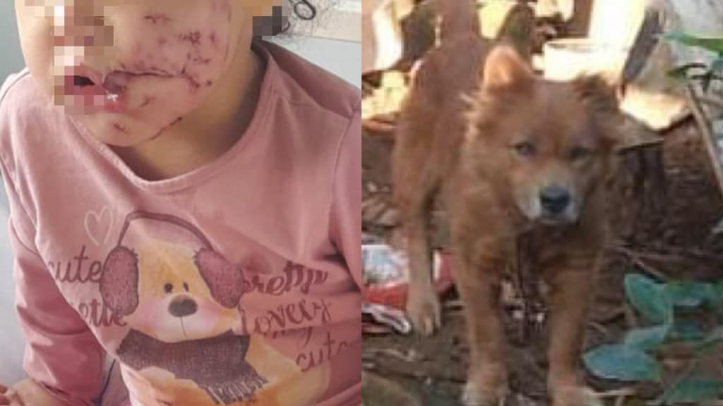 Cachorro invade quintal de residência e ataca criança