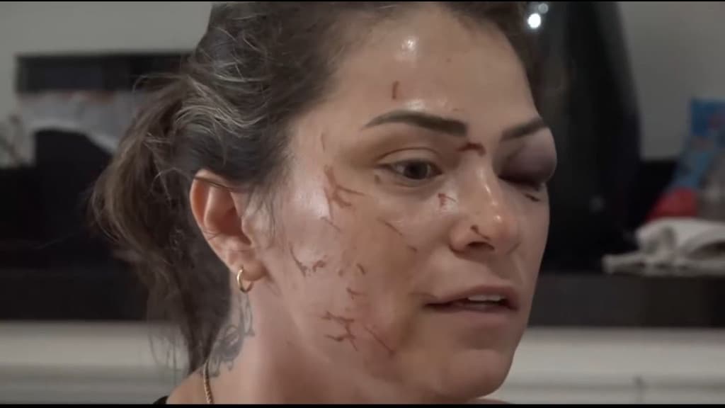 Mulher se revolta após ser espancada pelo ex-marido, em SC
