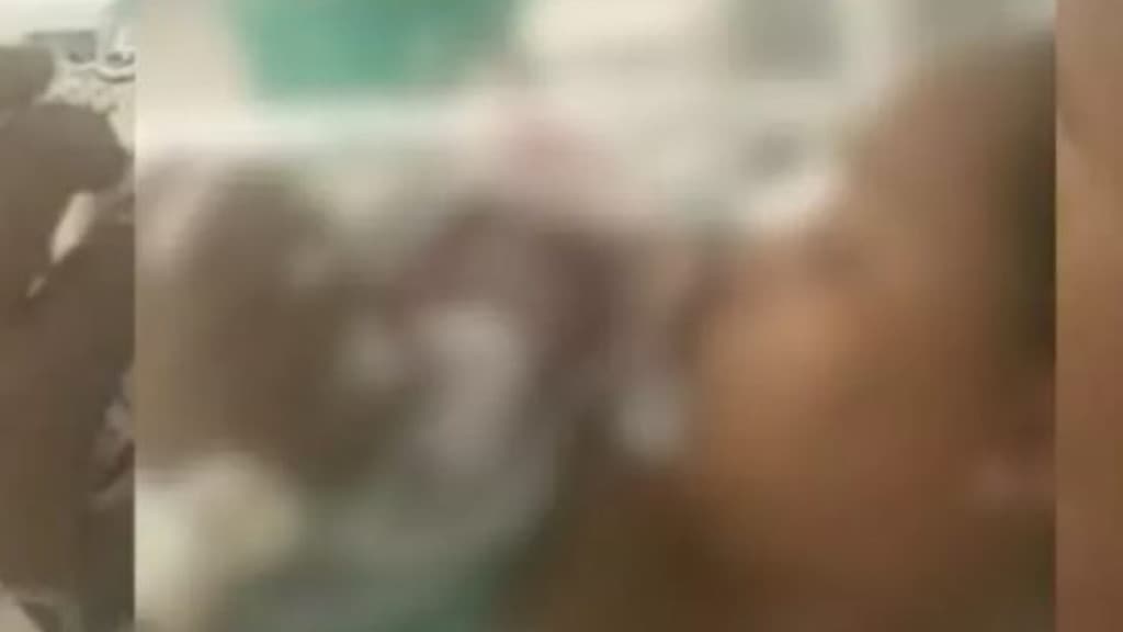 Mãe de bebê com cabeça cortada durante parto teve placenta retirada sem anestesia em SC