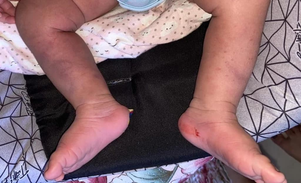 Mãe denuncia que filha bebê sofreu violência em centro de saúde de Tijucas