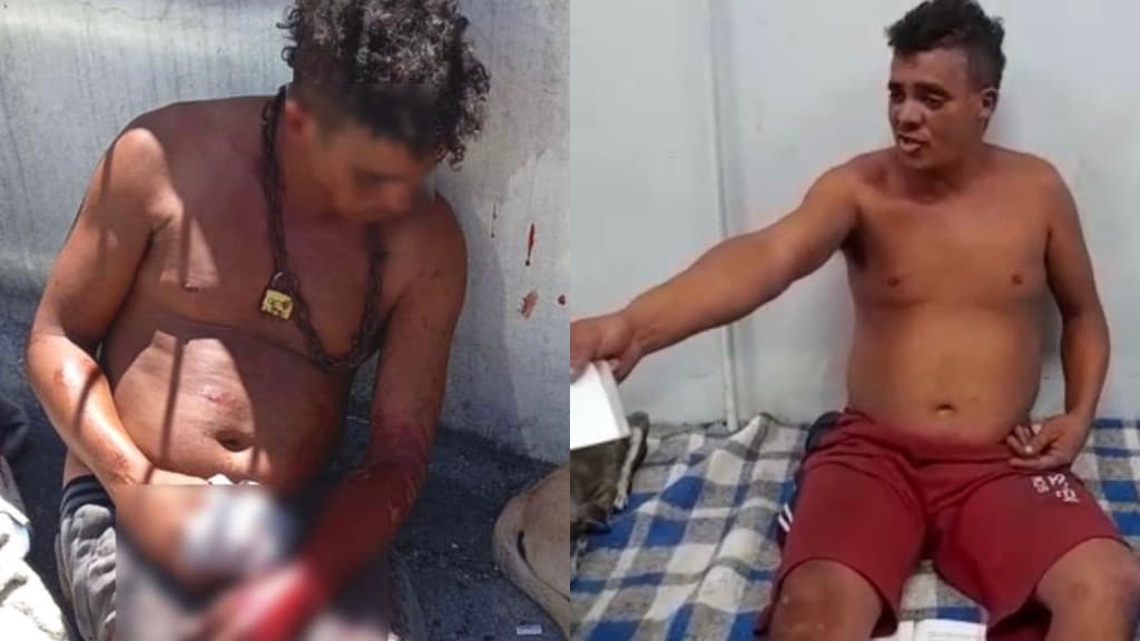 “Vão atear fogo em mim”, diz morador de rua após ser ameaçado em Tijucas