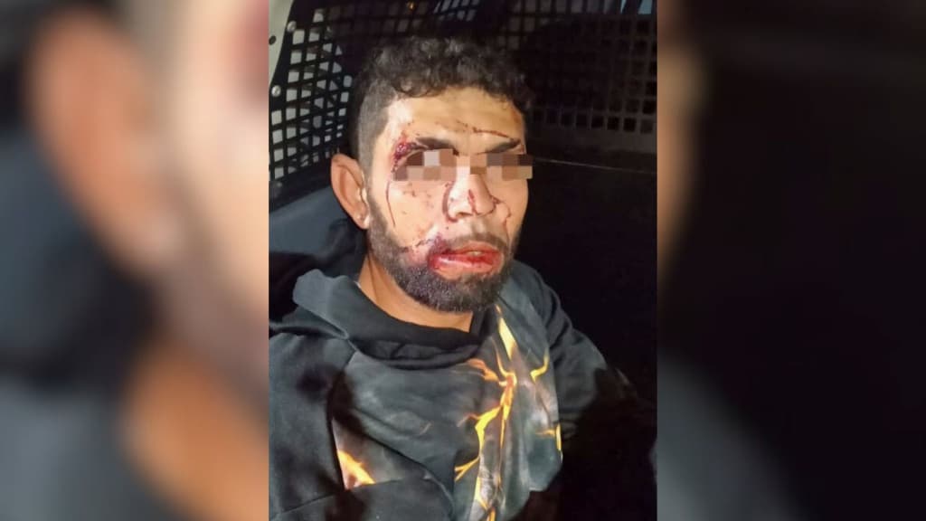 “Caiu sozinho”: ladrão é preso após ser flagrado por moradores de Itapema