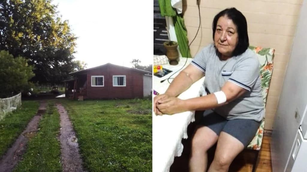 “Senti que ia morrer”, diz mulher que foi atingida por raio dentro de casa em Lages