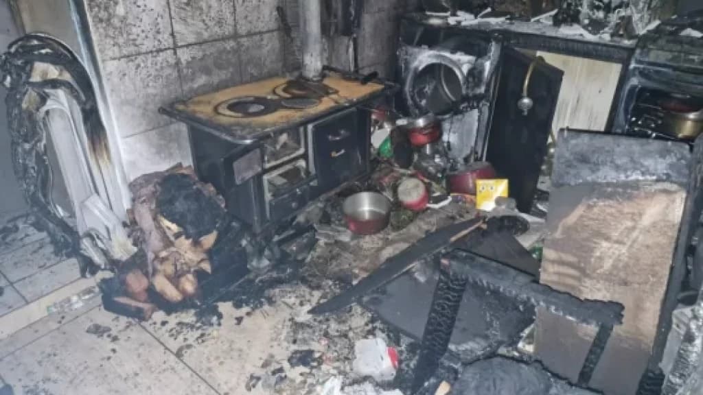 Mulher sofre queimaduras ao acender fogão à lenha com álcool