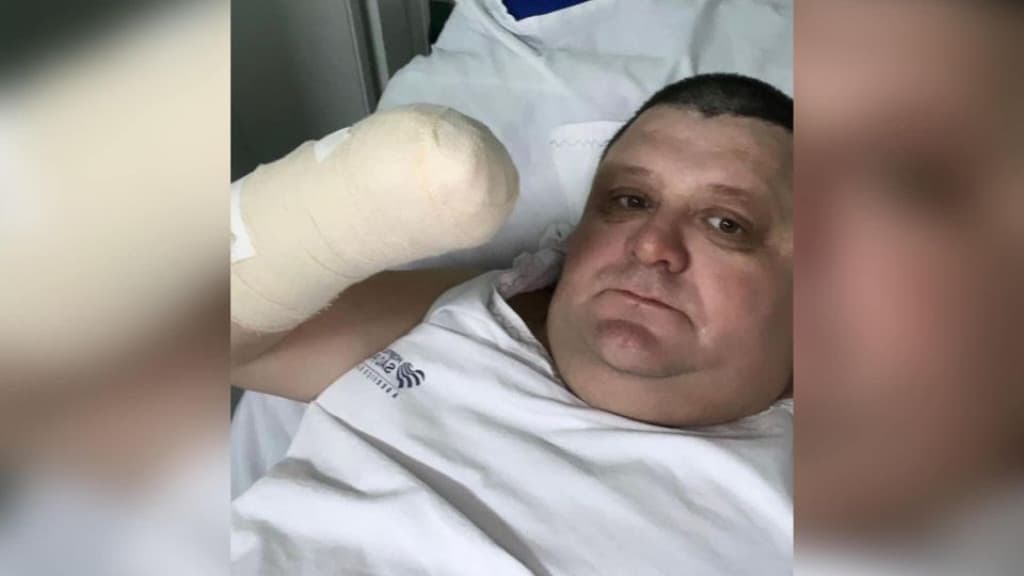Humorista perde a mão após explosão de foguete em SC