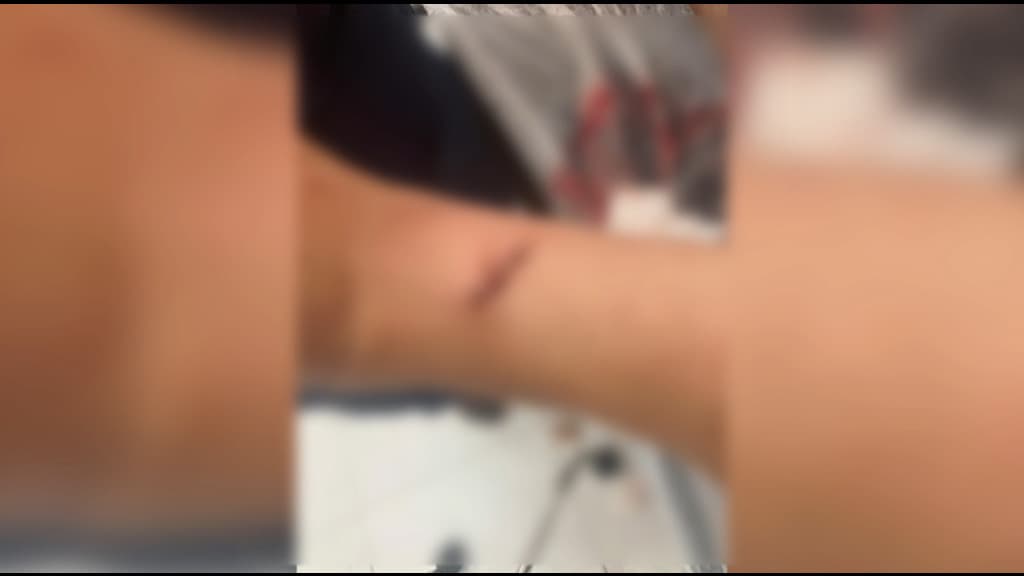 Homem esfaqueia esposa no pescoço em Bombinhas e acaba preso