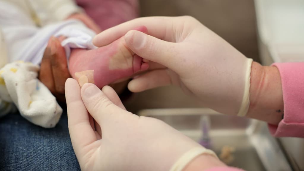 Santa Catarina amplia Teste do Pezinho que agora permite detecção da toxoplasmose