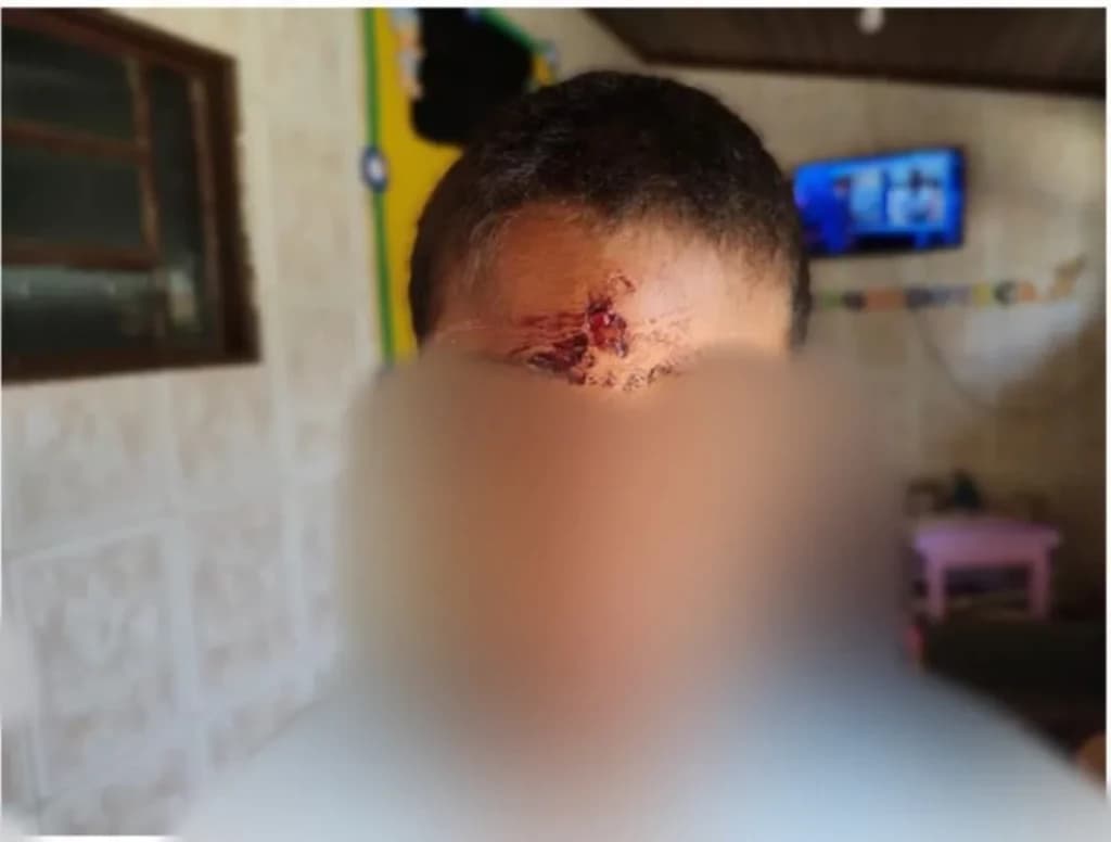 Mãe é presa após jogar pedra na testa do próprio filho de 7 anos