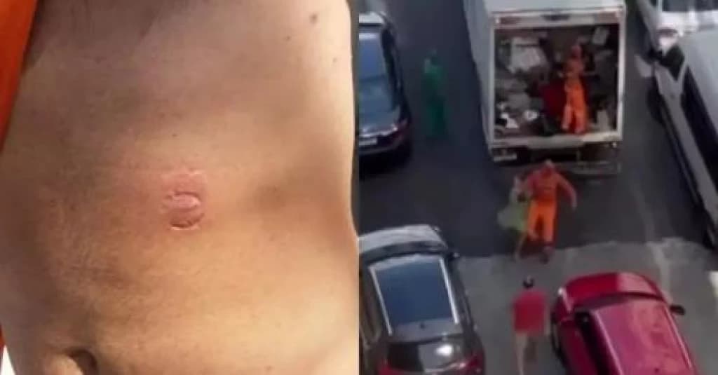 VÍDEO: Gari é agredido e mordido por uma mulher enquanto trabalhava em Itapema
