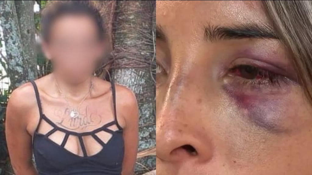 Mulher é espancada por moradora de rua durante assalto em  Florianópolis