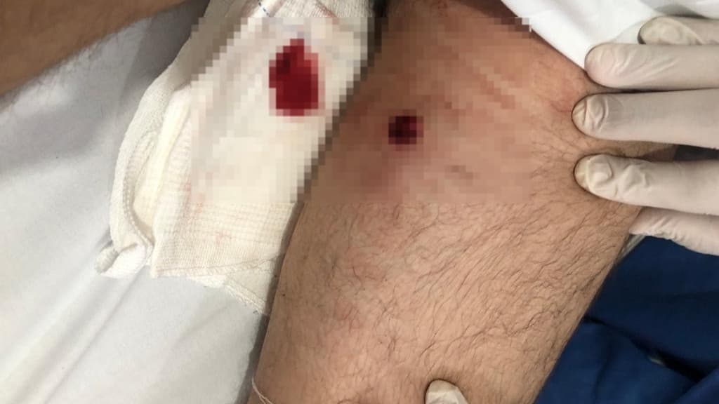 Homem é baleado após ser retirado de balada em Porto Belo