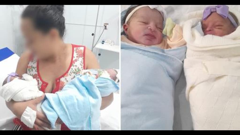 Mãe que deu à luz gêmeas sem saber da gravidez acreditou estar com dor de barriga durante as contrações