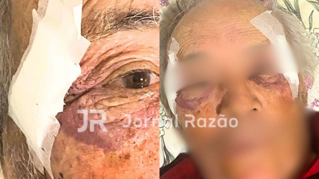 Idoso de 85 anos é violentamente espancado por moradores de rua em rodovia de SC