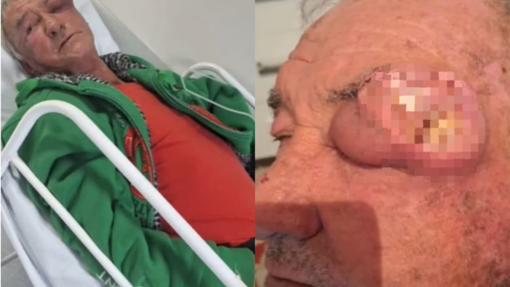 Idoso com câncer grave é “abandonado” no corredor de hospital em SC
