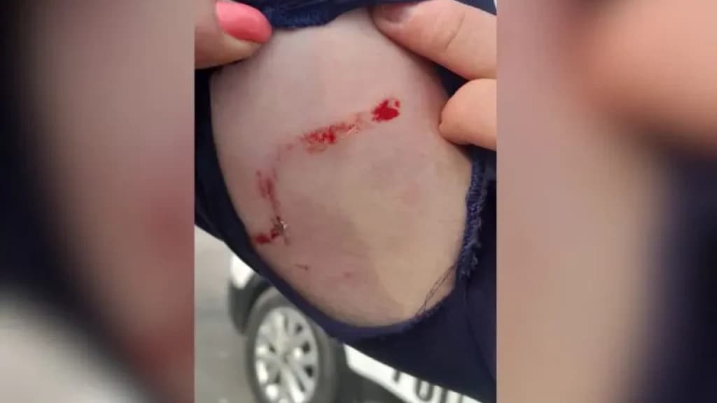 Com medo de ser preso homem solta Pit bull para atacar Guarda Municipal de Itapema