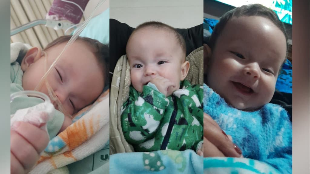 Criança que nasceu com má formação cerebral precisa de cirurgia urgente