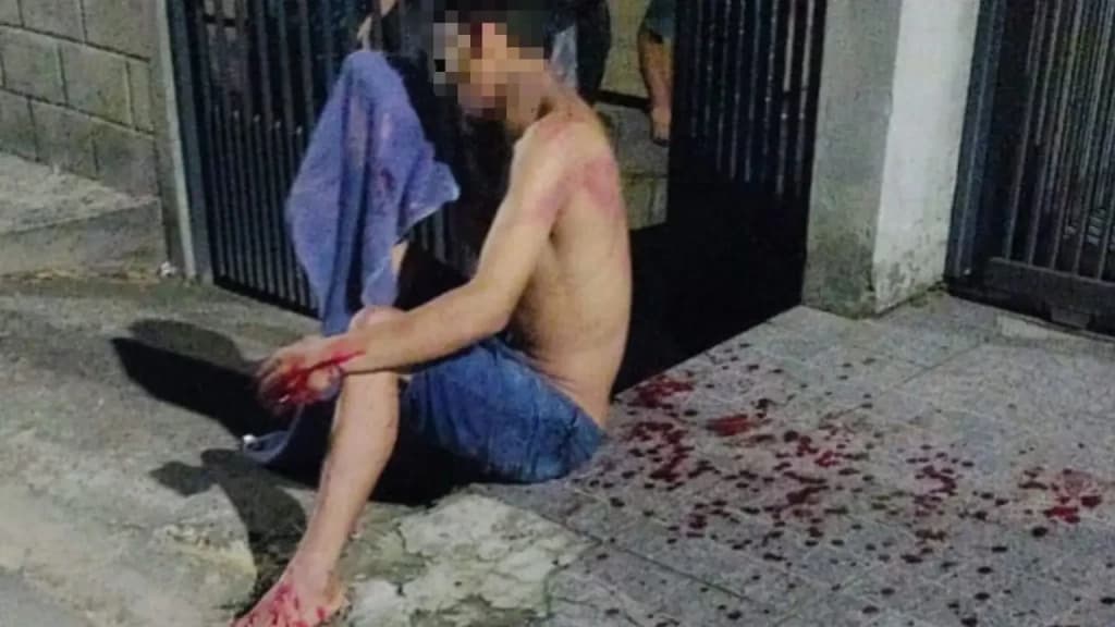 Homem fica completamente ensanguentado ao ser espancado por quatro homens em SC