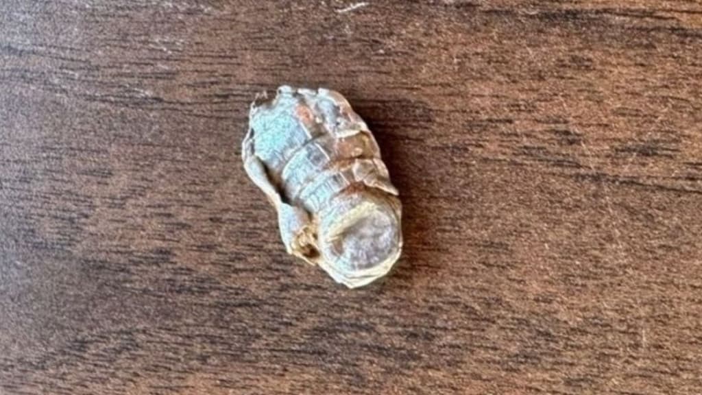 Criança de 4 anos é atingida na cabeça por bala perdida em SC
