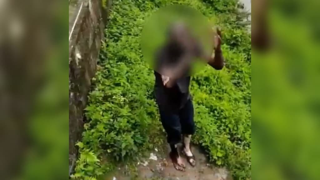 Morador de rua tem 80% do corpo queimado ao tentar furtar fios de cobre em Florianópolis