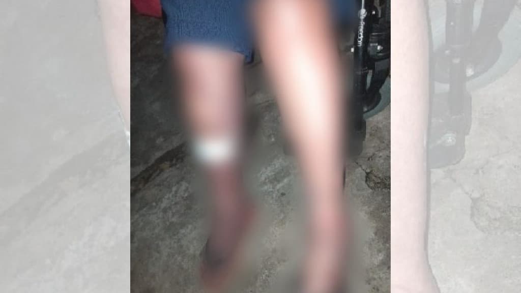 Filho bêbado agride mãe cadeirante de 72 anos a pauladas