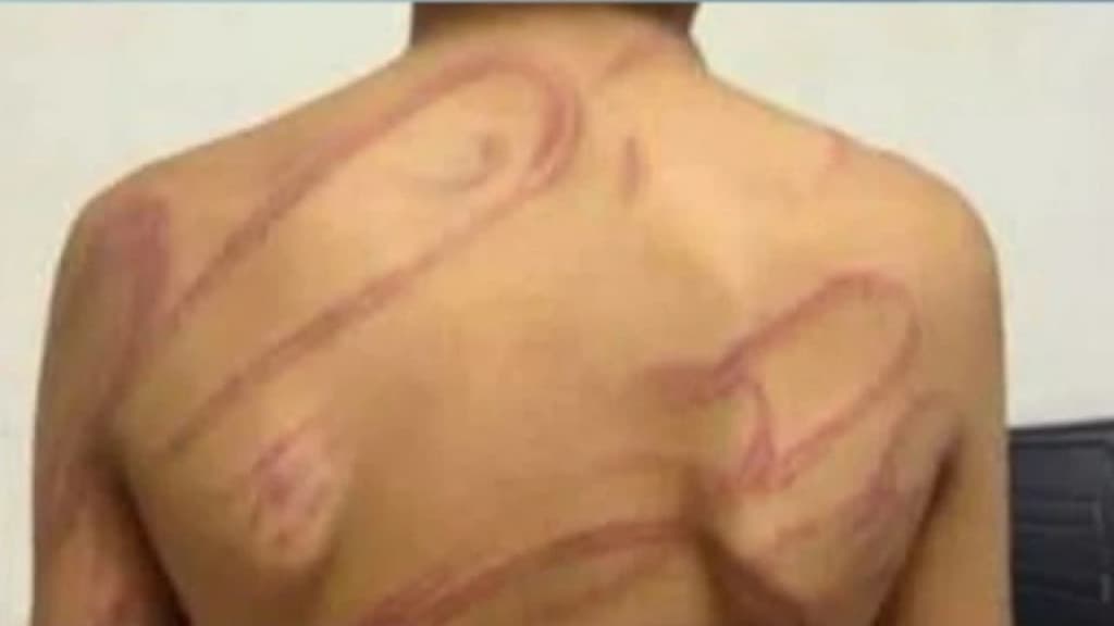 “Apanhou de chicote”: Morador de Itapema denuncia ex-companheira após espancar filho com TDAH