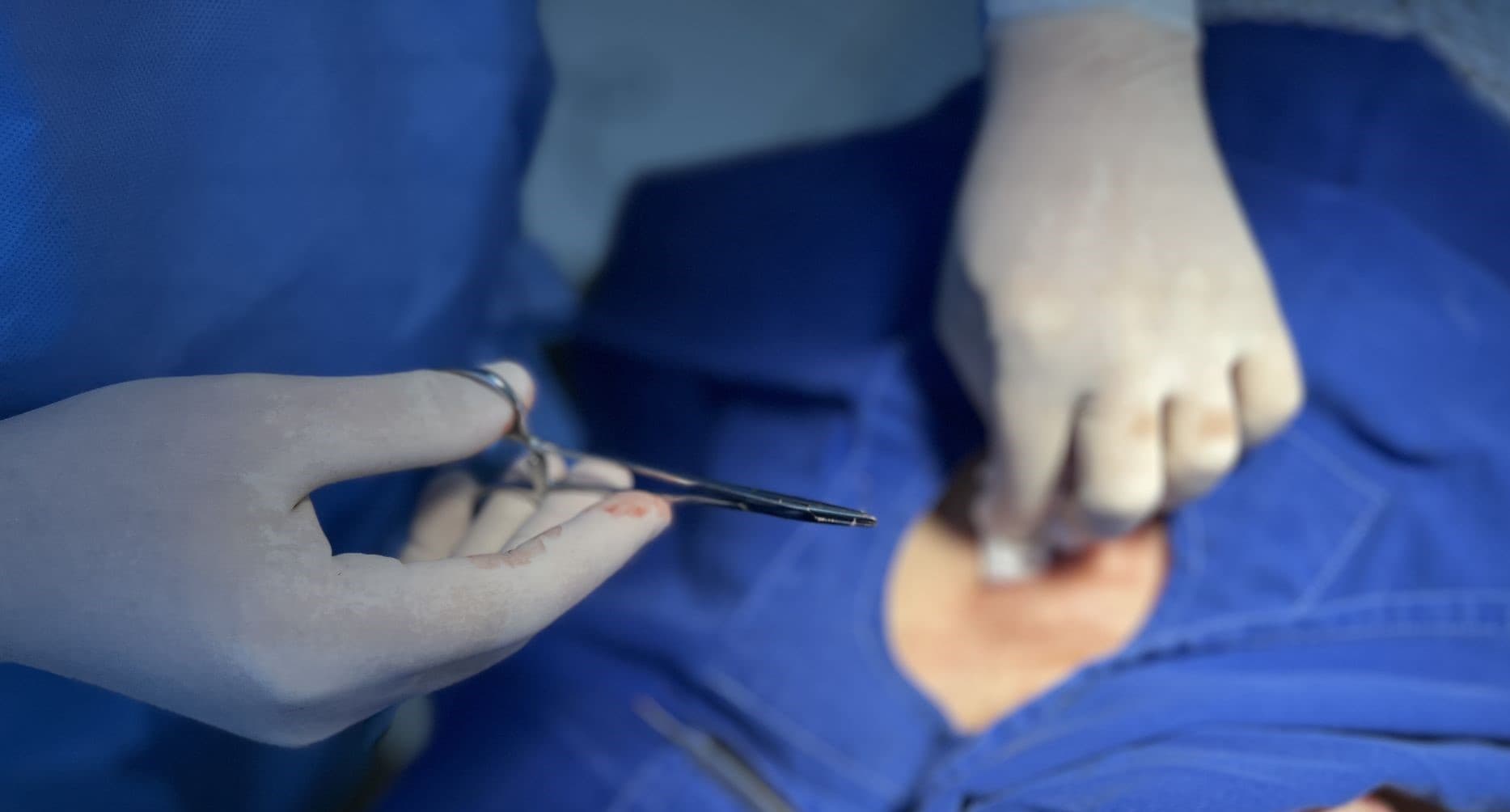Hospital Santa Teresa promove mutirão de cirurgias para combater o câncer de pele