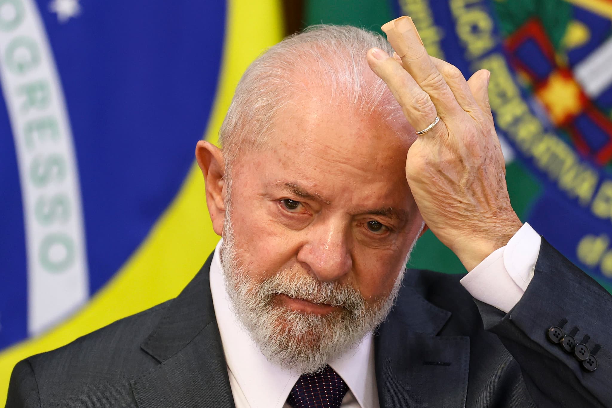 Lula passará por novo procedimento para evitar novos sangramentos no cérebro