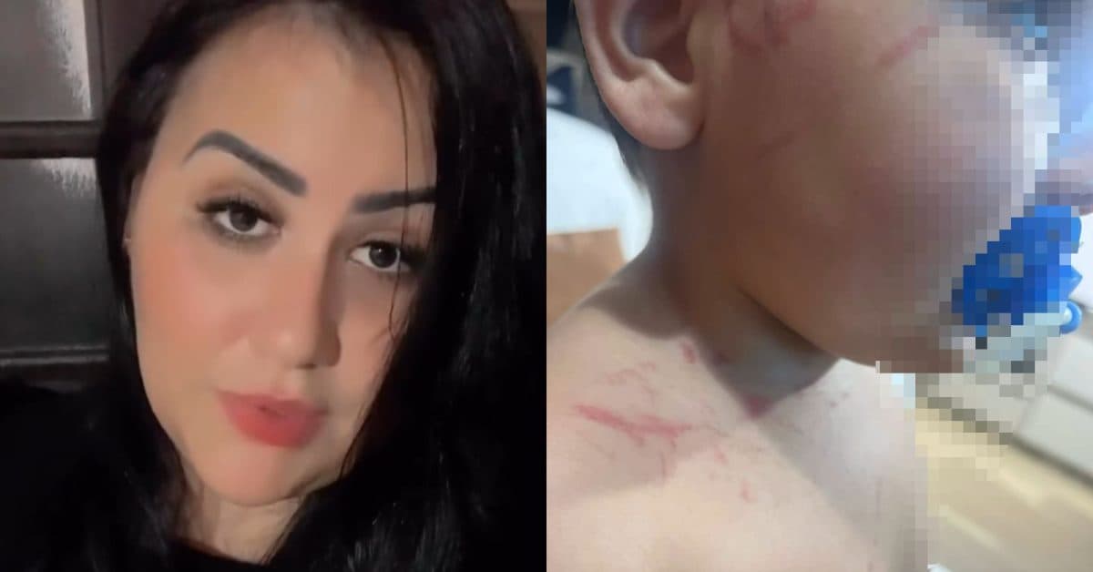 “Eu quero justiça”: Mãe se revolta após filho chegar de creche com marcas pelo corpo