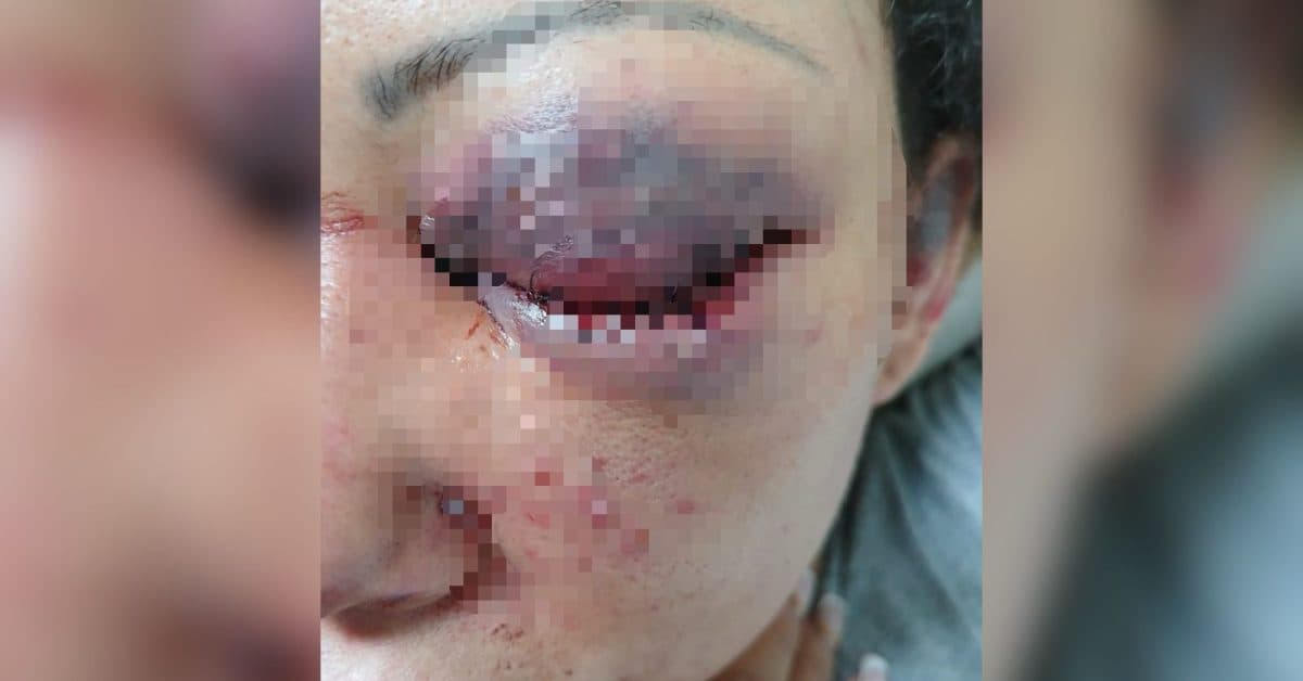 Criança salva a mãe ao chamar a PM enquanto ela era espancada pelo pai em SC