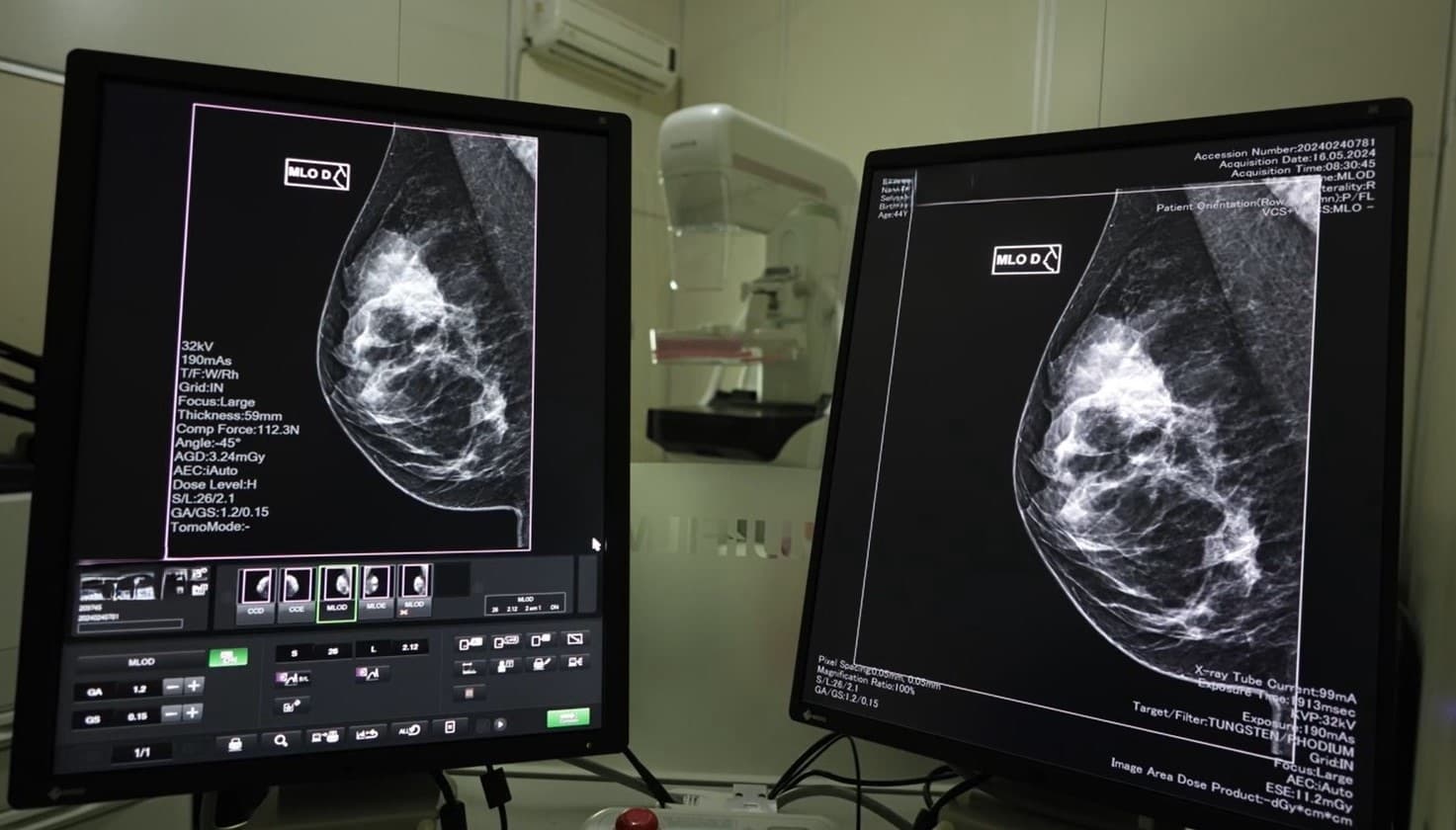 Governo lança mutirão de mamografias no mês da Mulher