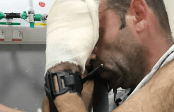 Homem quase perde a mão com esmerilhadeira e é salvo por PMs após corrida contra o tempo em Blumenau
