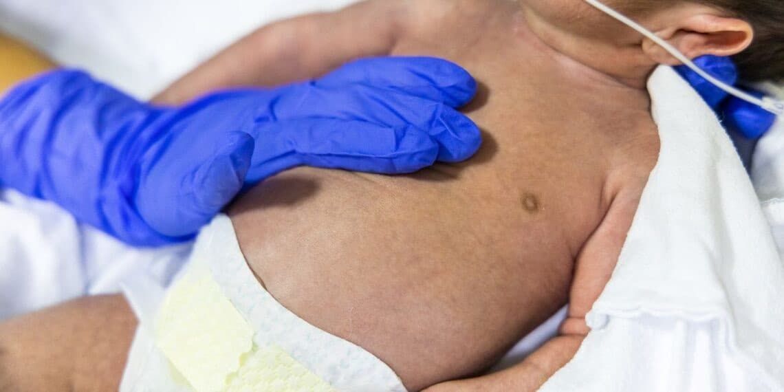 Cresce número de bebês internados por doenças respiratórias em Florianópolis