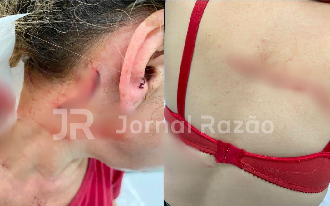Mulher é atacada e esfaqueada no pescoço por moradora de rua em Florianópolis
