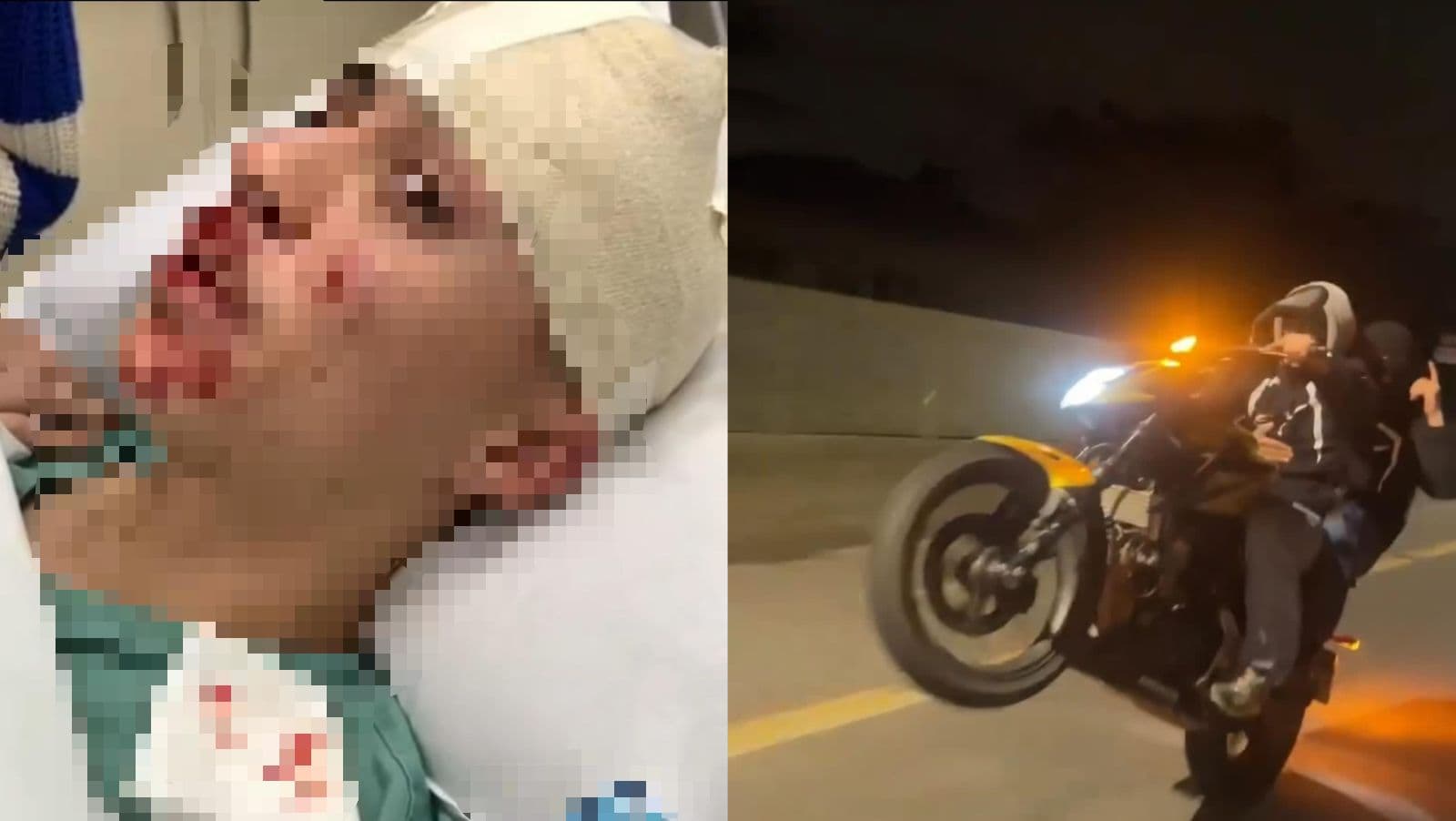 “Diabo atentou contra minha vida”, diz jovem que quase morreu ao bater moto em SC