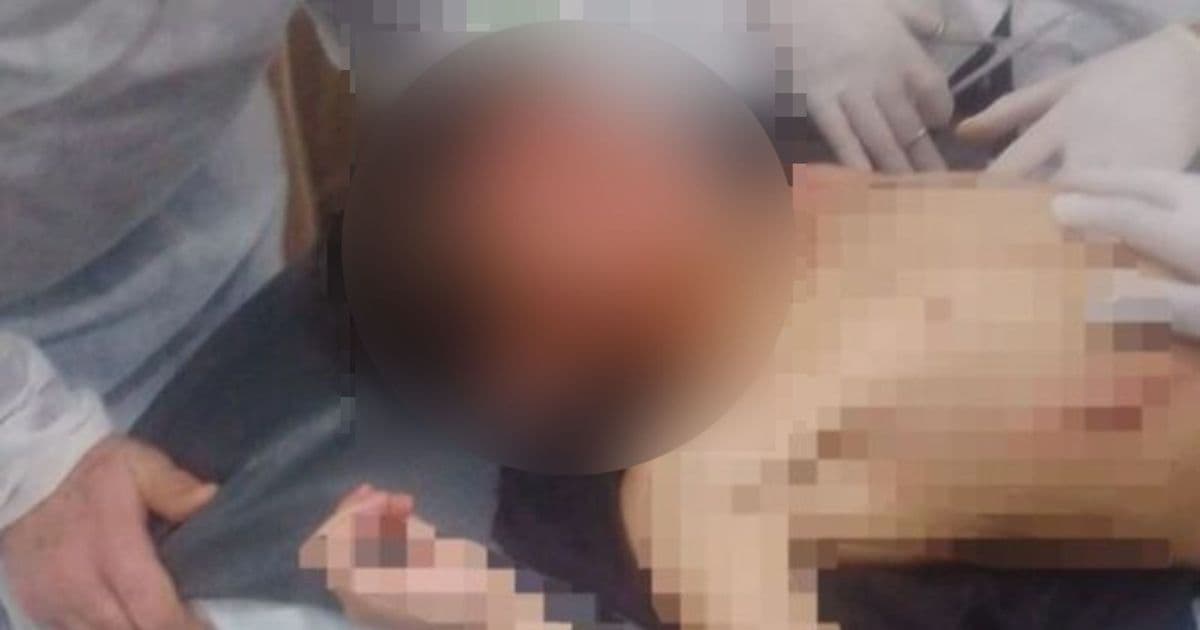 Pitbull salta muro de residência e ataca criança de 7 anos em SC