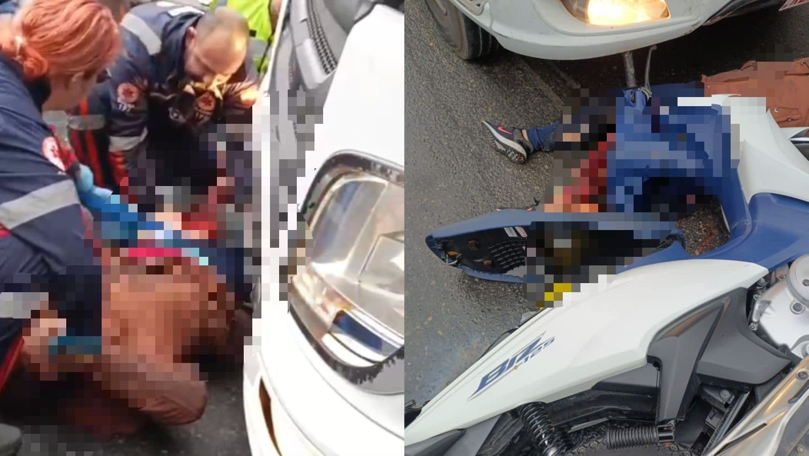 Motociclista tem perna dilacerada em grave acidente com caminhão na BR-470 em Navegantes