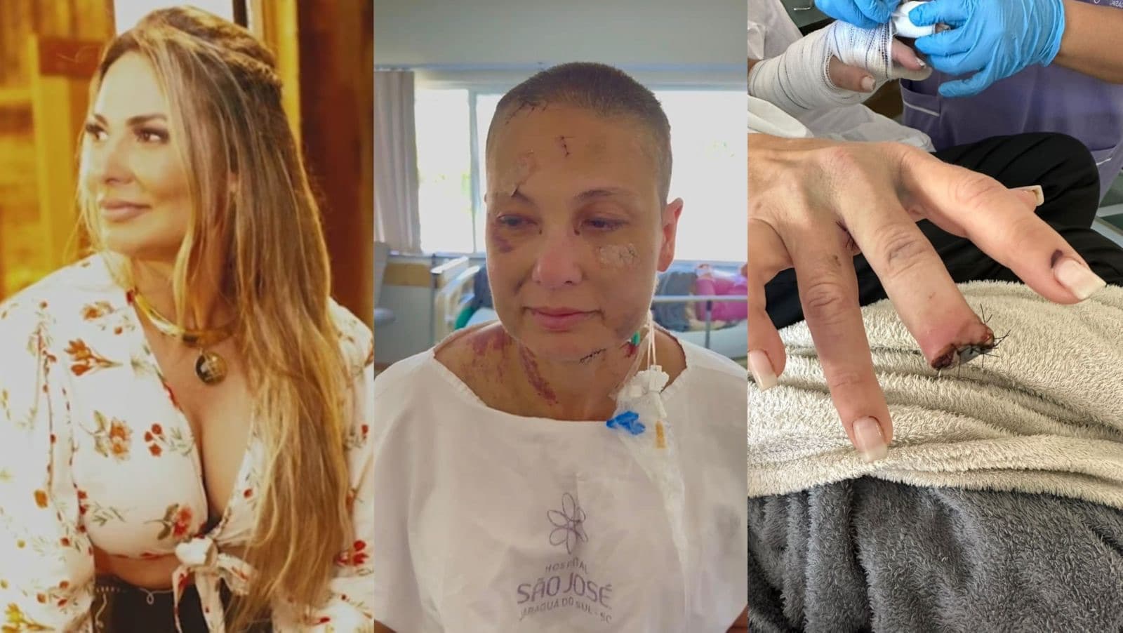 Com mordida, barra de ferro e ameaça de morte, enteado quase mata madrasta em SC e é solto