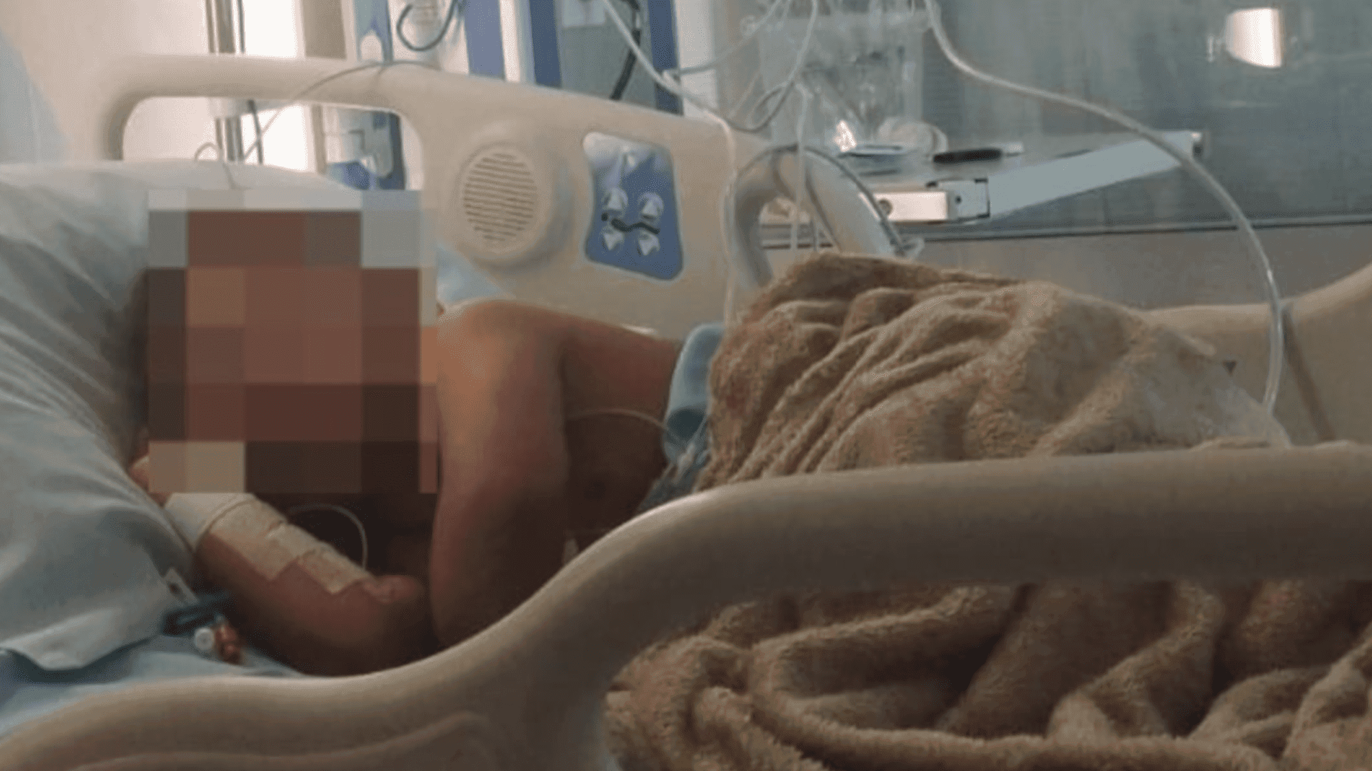 Criança de 5 anos sofre fratura no crânio após ser atropelada por moto elétrica em Navegantes