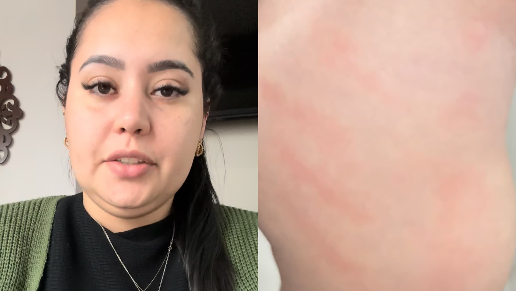 “Marcou a pele do meu anjo”: mãe encontra marca de palmada na filha ao retornar de creche em SC