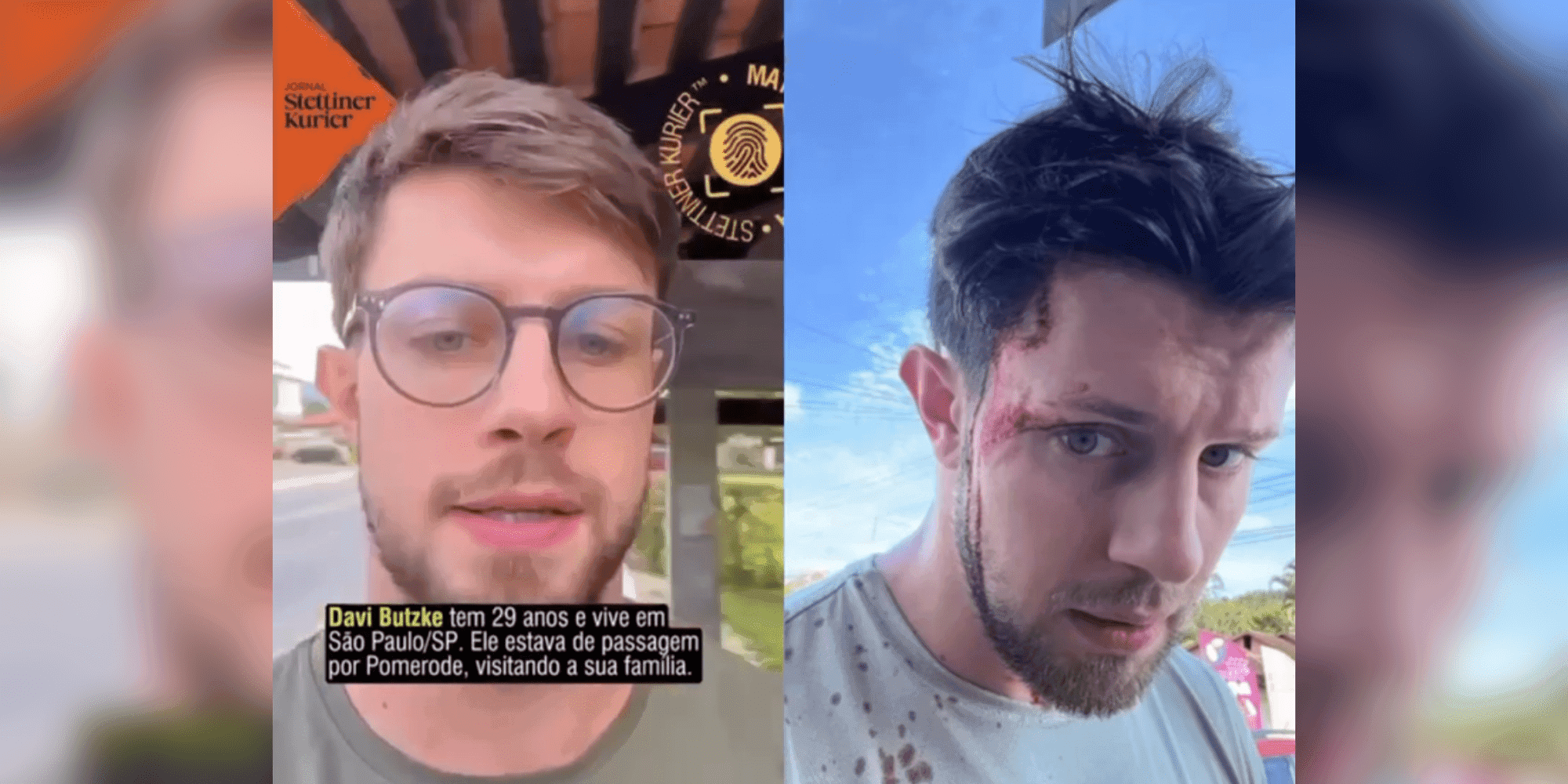 Turista bate a cabeça enquanto correria por rua em SC e grava vídeo revoltado