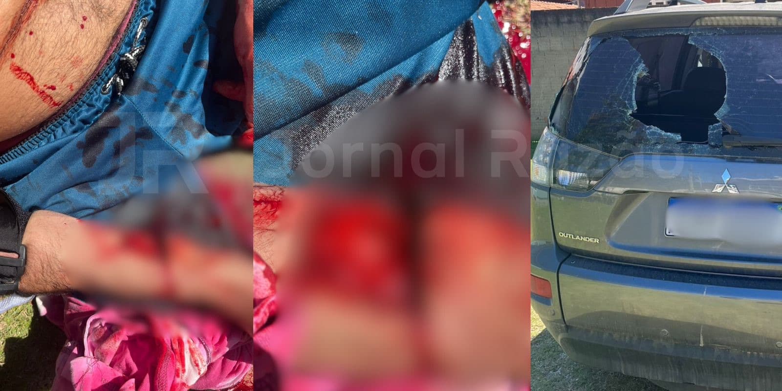 Homem em surto após usar drogas quebra vidro do carro da família e tem braço dilacerado em Bombinhas