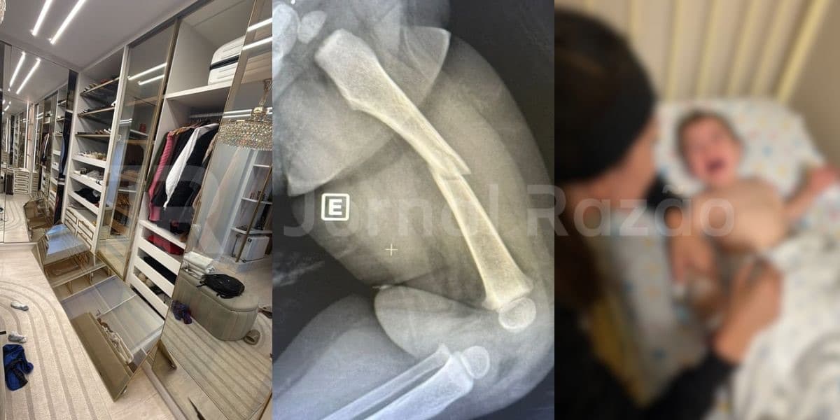 Bebê fratura o fêmur após porta de closet cair em SC: “família já havia alertado sobre falhas”
