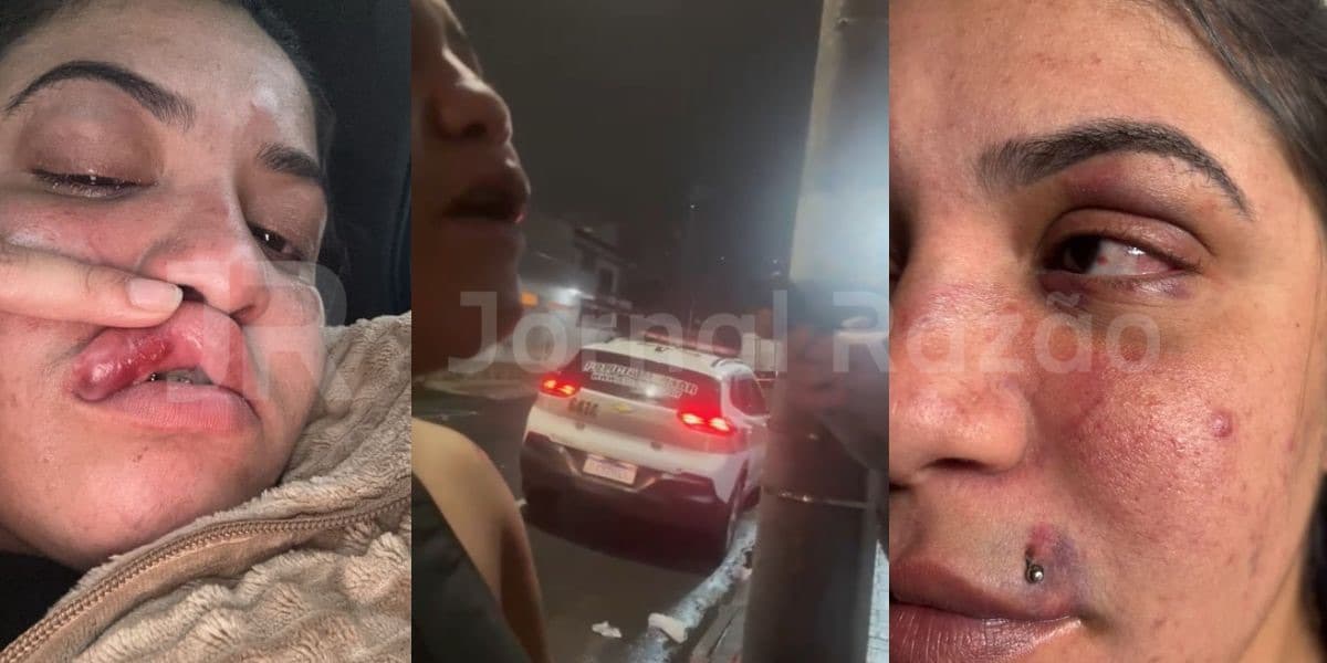 Turista diz ter sido agredida em balada de BC e detona SC: “aqui quem tem dinheiro ganha”