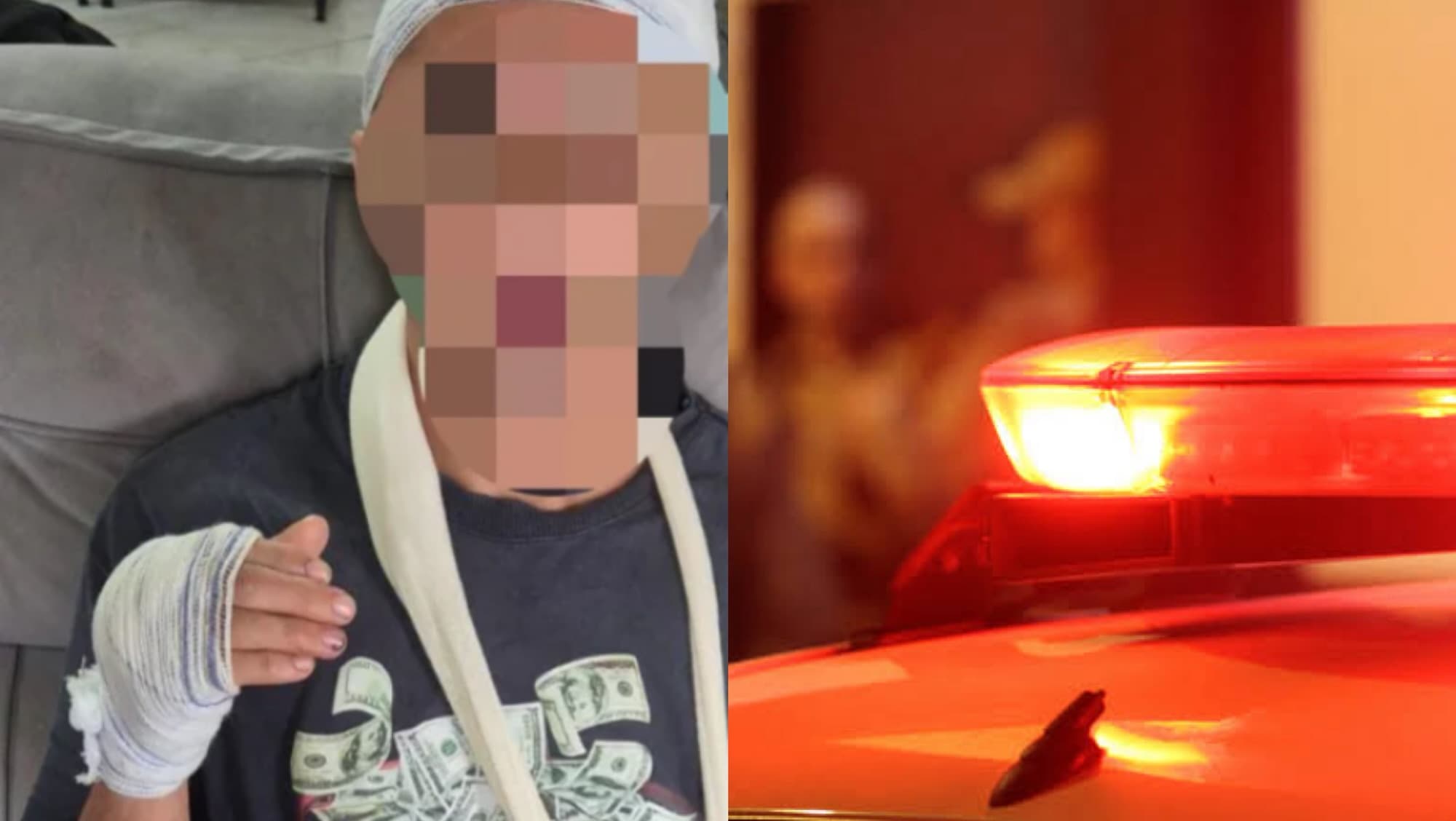 Trabalhador leva paulada na cabeça e tem dedo quebrado durante assalto em Porto Belo