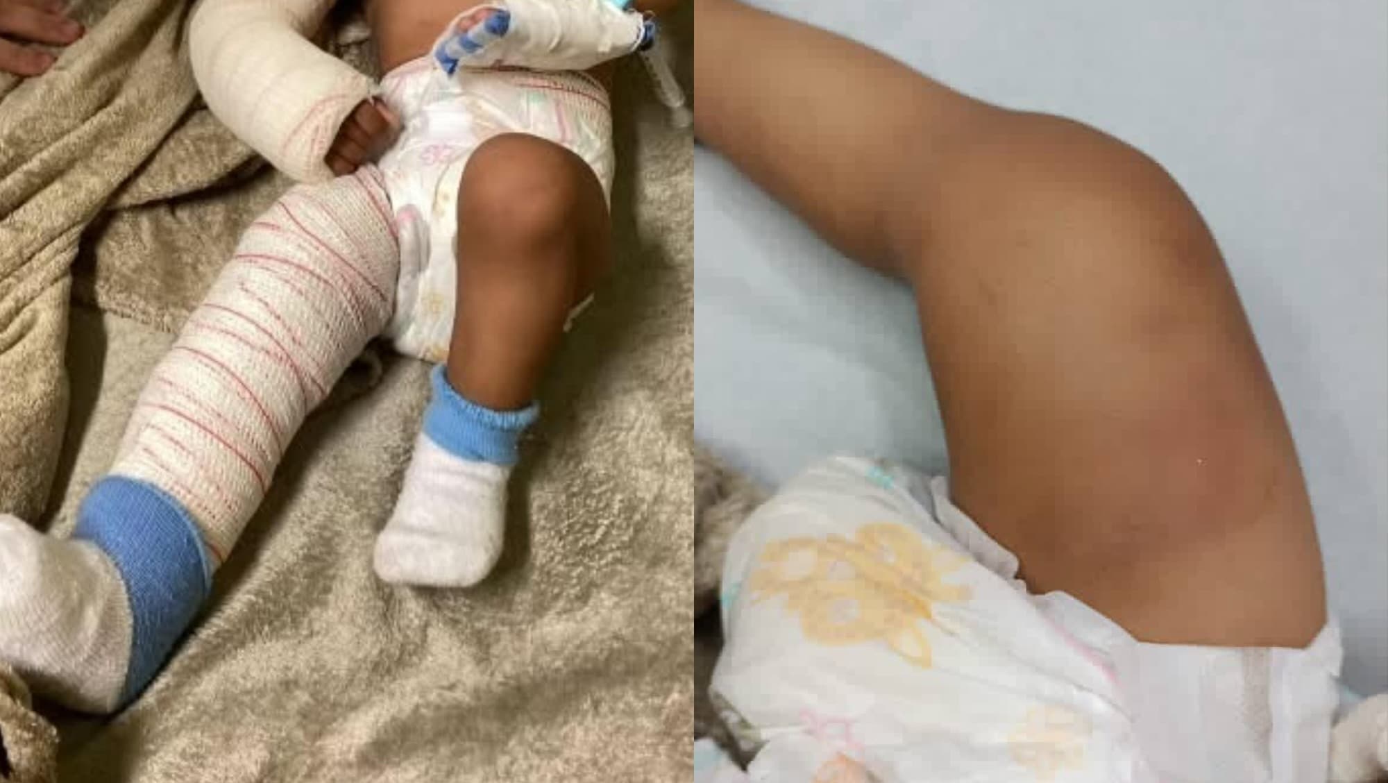 Bebê torturado pela própria mãe choca SC: adolescente de 16 anos foi detida em flagrante