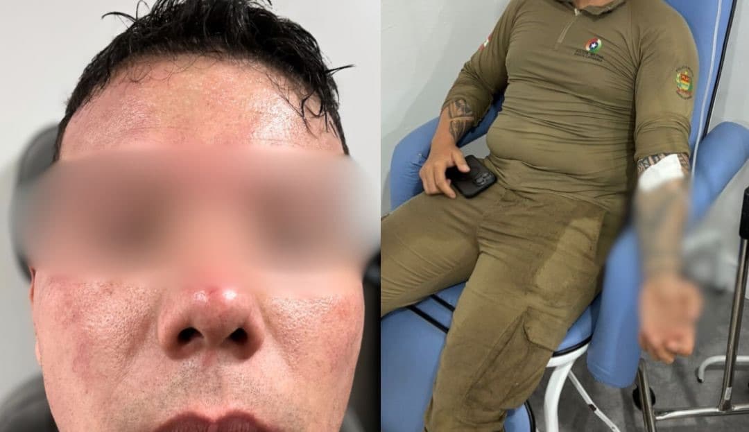 PMs levam 90 picadas, ignoram a dor e “se jogam no mato” para prender ladrão em SC