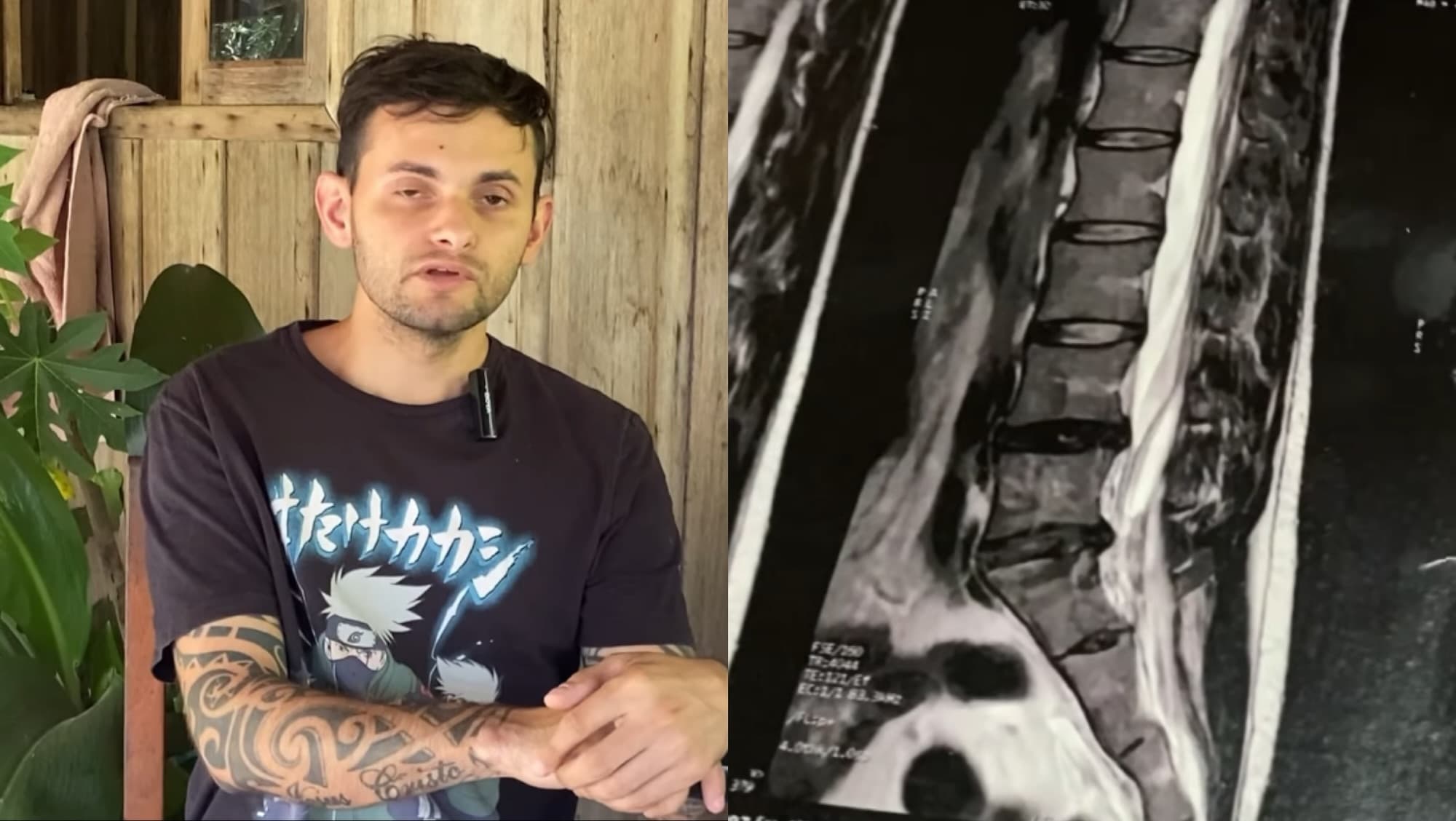 Morador de São João Batista rifa a própria moto para fazer cirurgia de emergência na coluna