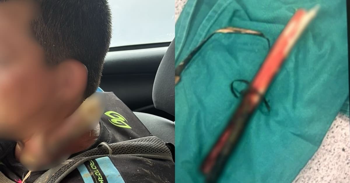 “Por um milagre”: Galho atravessa pescoço de trilheiro e homem sobrevive em SC
